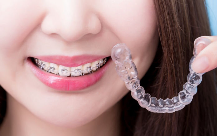 Invisalign Braces